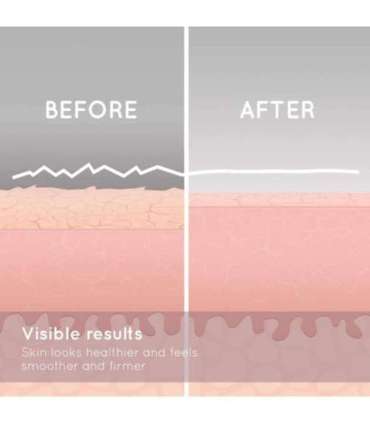 Homedics MDA-100RGA Radiance