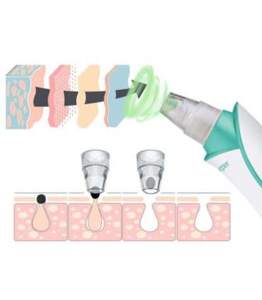 Beper P302VIS001 (EOL)