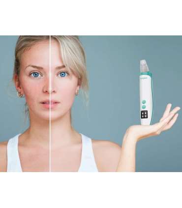 Beper P302VIS001 (EOL)